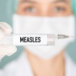 Measles Case San Diego