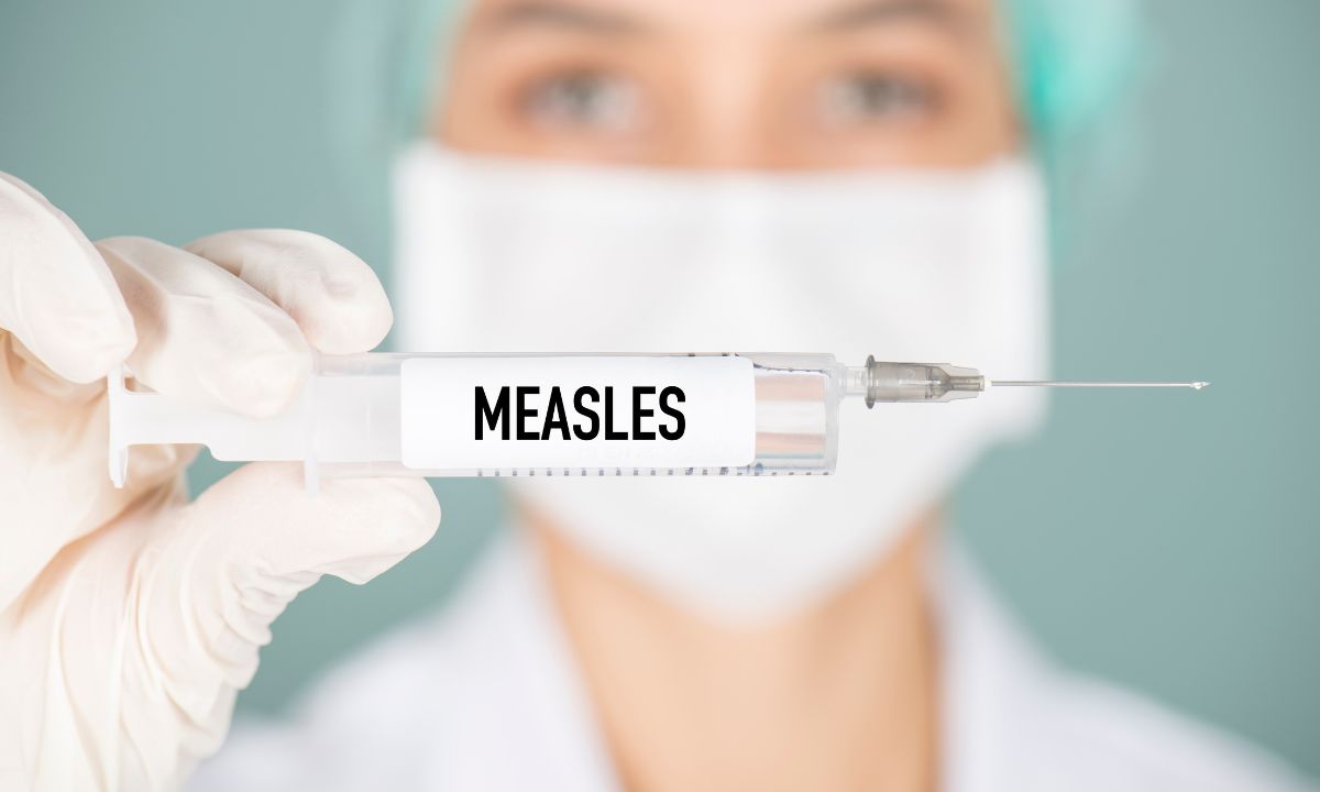 Measles Case San Diego